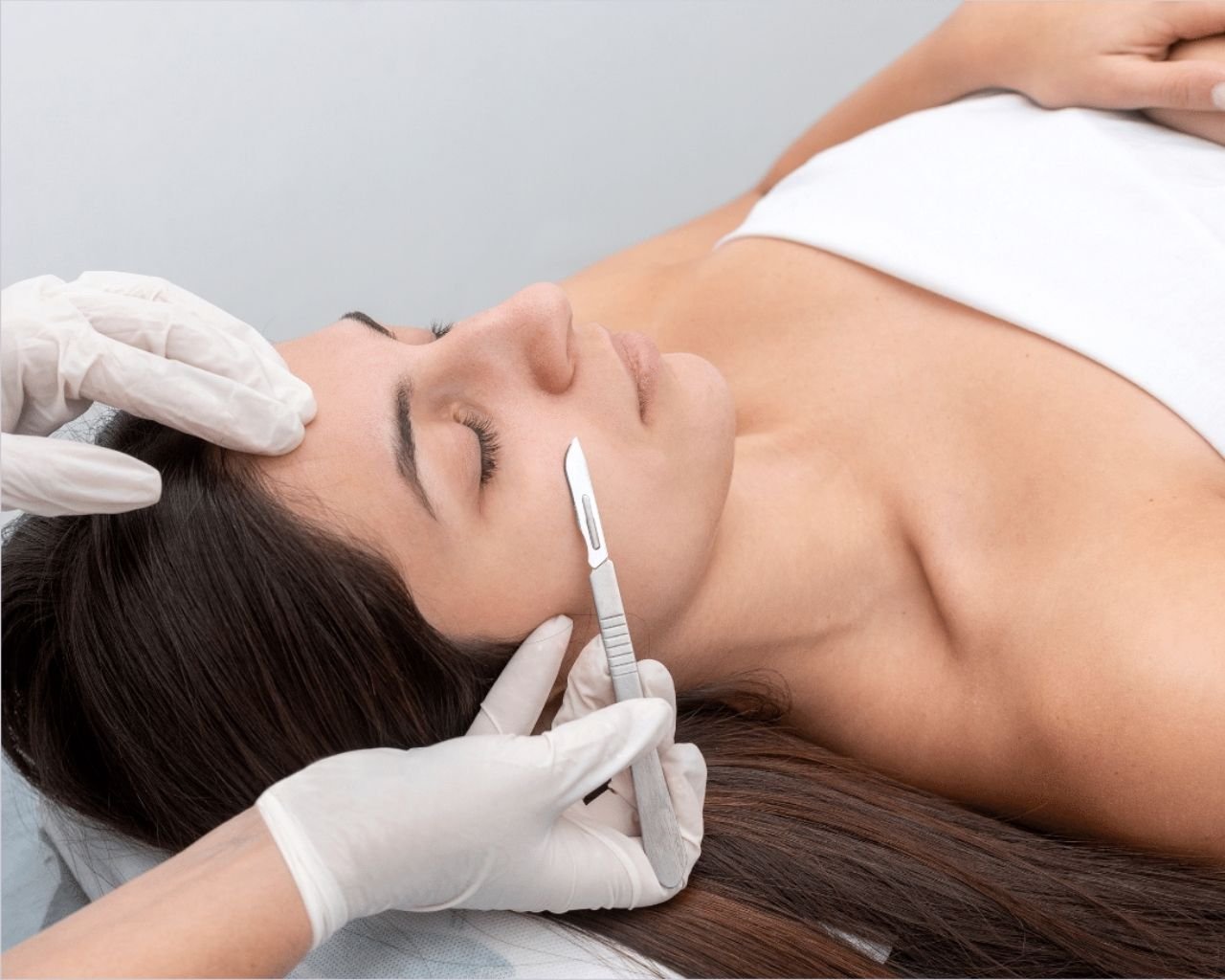 Dermaplaning