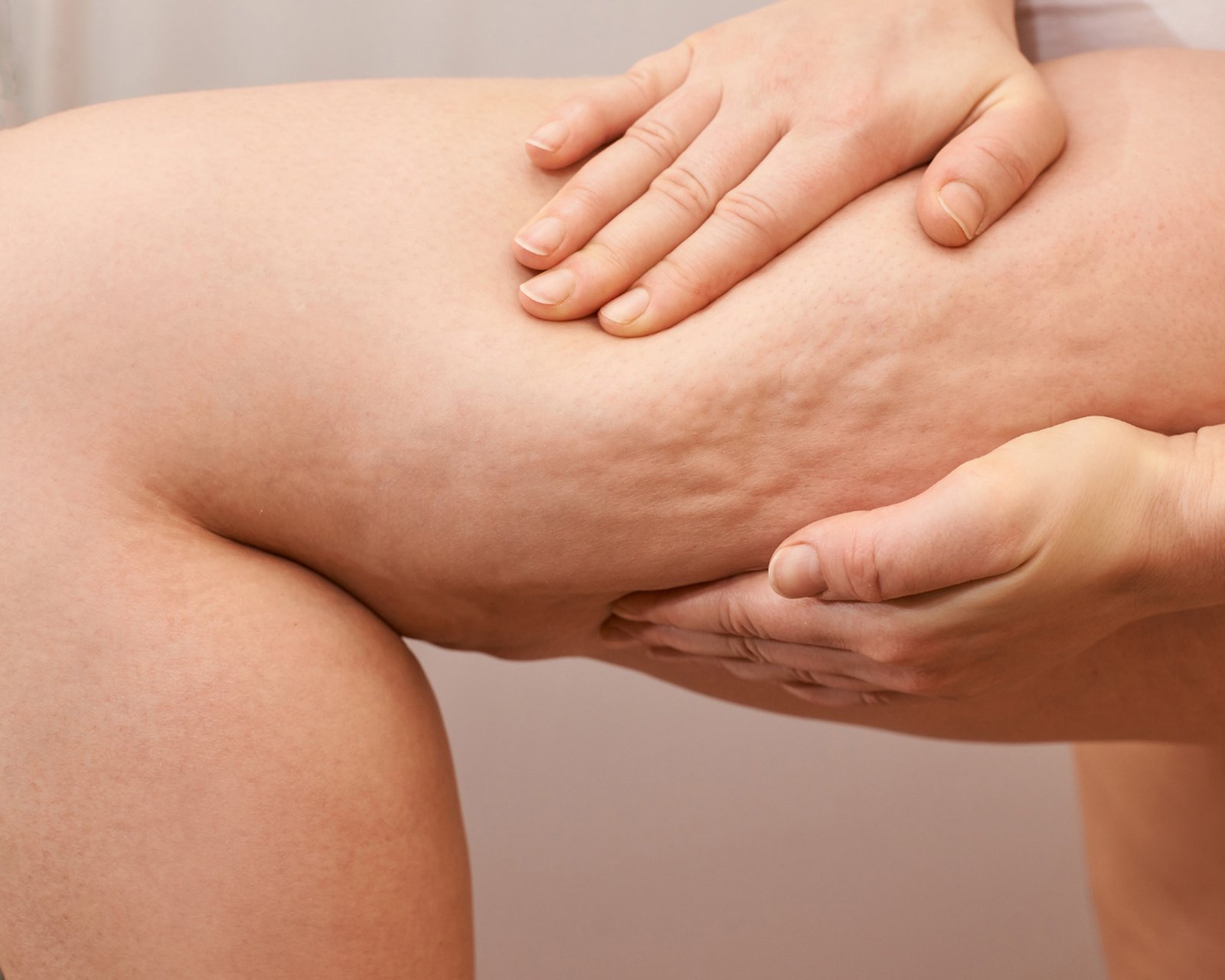 Celulite e Remodelagem (Contornos)